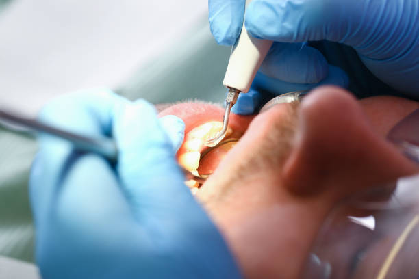 Emergency Gum Pain Relief in MI