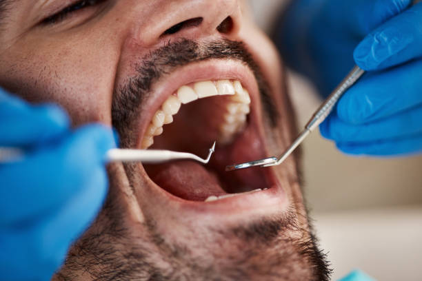 Best Dentist for Tooth Abscess  in Bessemer, MI